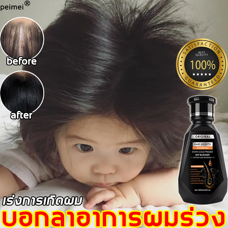 ลดพิเศษ แชมพูขิงบริสุทธิ์ ปลูกผมใหม่ ลดผมร่วง บำรุงรากผมอย่างล้ำลึก ด้วยสูตรสมุนไพรธรรมชาติ