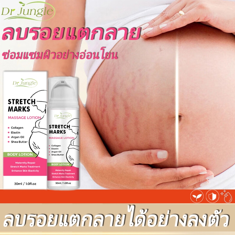 【การกำจัดที่สมบูรณ์แบบ】Dr.Jungle ครีมทาท้องลาย ครีมลดรอยแตกลาย 30ml แก้แตกลาย อ่อนโยนไม่ระคายเคือง