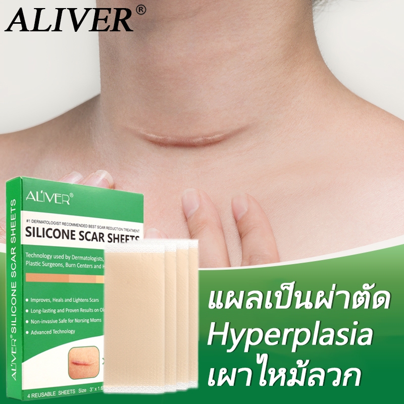 ALIVER แผ่นแปะรักษารอยแผลเป็น ลดรอยแผลเป็นนูน ทั้งเก่าใหม่ คีลอย ตัดตามต้องการ
