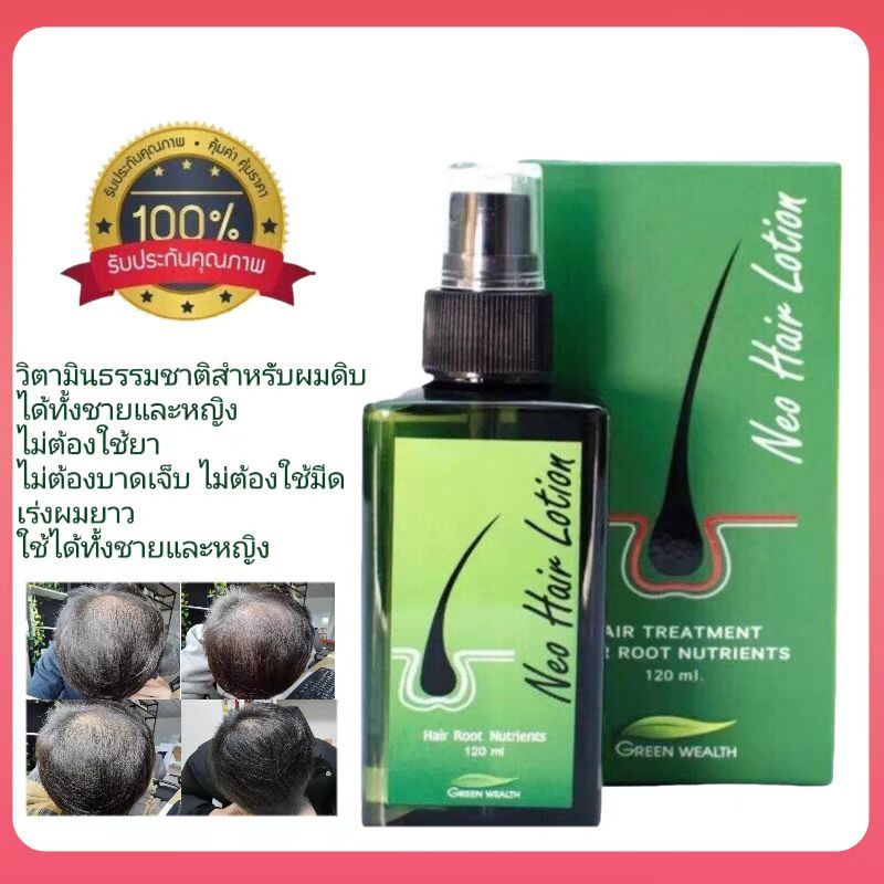 Neo Hair Lotion 120ml ผลิตภัณฑ์สเปรย์ปลูกผมและบำรุงรากผม เหมาะสำหรับคนผมบาง