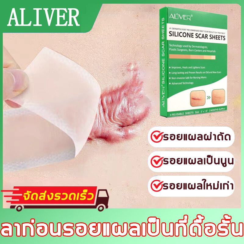 โปรโมชั่นแท้☘️แผ่นแปะซิลิโคนลบรอยแผลเป็น ใช้ง่าย ตัดขนาดได้ตามต้องการ เหมาะกับรอยแผลคีลอยด์และรอยแตกลาย เผยผิวเรียบเนียน