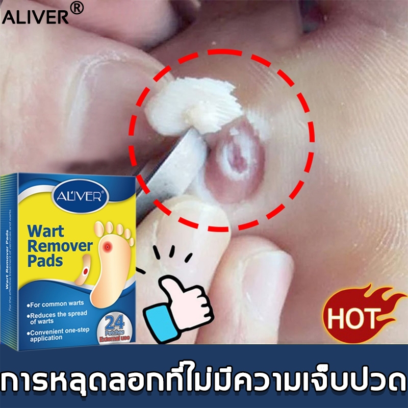 พร้อมส่ง ALIVER แผ่นแปะเท้า (24 แผ่น/กล่อง) กำจัดแบบไม่เจ็บ ปลอดภัย ดูแลสุขภาพเท้า