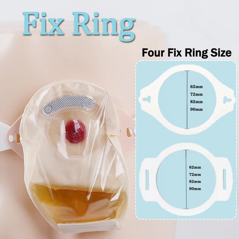 1PC Ostomy กระเป๋าเสริม,Stoma Leak-Proof BUCKLE แหวนคงที่ Stoma เข็มขัดอุปกรณ์เสริม