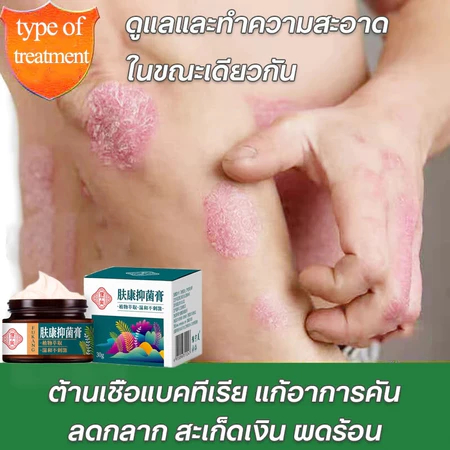 (COD ของแท้ ) ครีมลดอาการคัน ทาแก้คัน ครีมทารา ผิวหนัง ทาแก้อาการคันในร่มผ้า ทากากเกลื้อน รักษาสังคัง