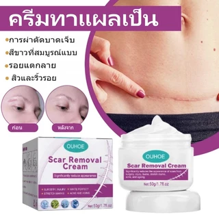COD ของแท้ มลดรอยแผลเป็น แผลเป็น รแผลไฟไหม้ น้ำร้อนลว แผลผ่าตัด รอยแตกลายหลังครรภ์ แผลใหม่และแผลเป็นเก่า 50ml