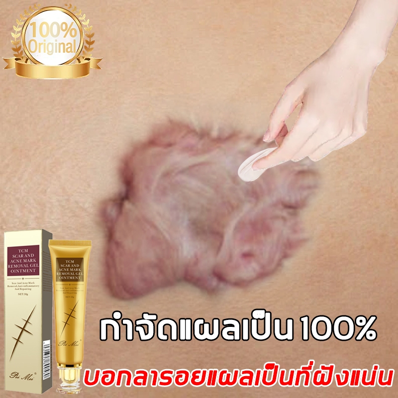 ครีมลดรอยแผลเป็น 30g ฟื้นฟูสําหรับแผลผ่าตัด แผลเป็นนูน สําหรับแผลเป็นเก่าและใหม่