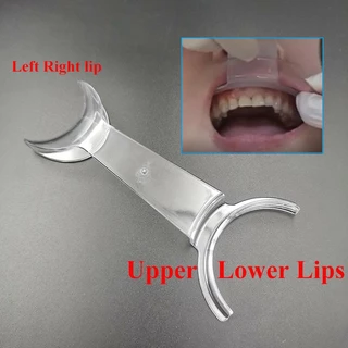 5/10ชิ้นปากขยายปากปากปากretractor Intraoral Cheek Upper Lower Lip Retractorทันตกรรมเปิดปากเครื่องมือทันตแพทย์