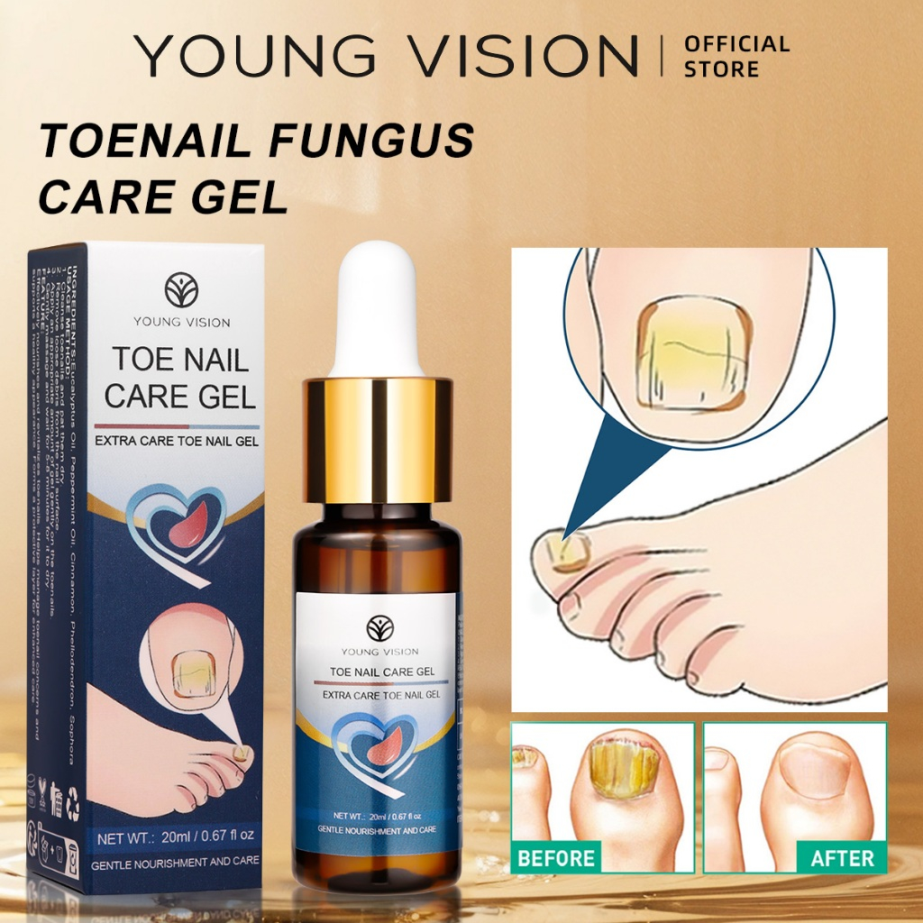 YOUNG VISION น้ํามันหอมระเหยดูแลเล็บเท้า
