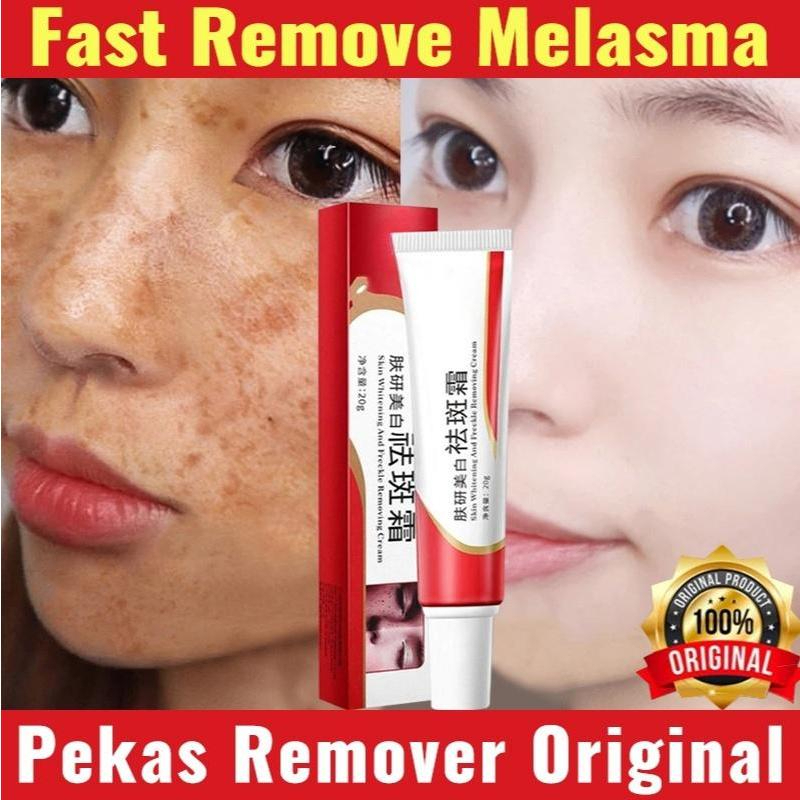 Pekas Eraser Cream - Advanced Melasma Dark Spot Remover Cream with Whitening Moisturizer for Smooth