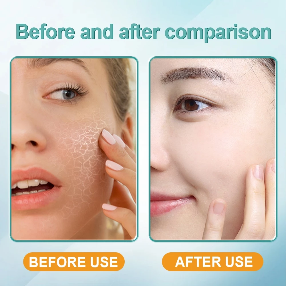 BSKM serum เซรั่มกรดไฮยาลูโรนิก 28ml มอยส์เจอไรเซอร์ ไวท์เทนนิ่ง เซรั่มบำรุงผิวหน้า สกินแคร์ ไบรท์เทนนิ่ง ไฮเดรทติ้ง รีแพร์ thumbnail 5