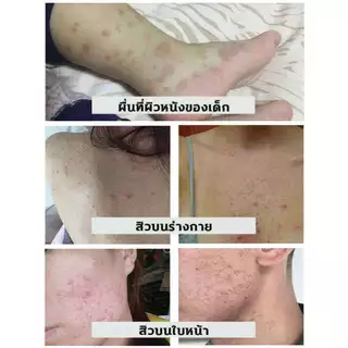 สเปรย์กำจัดไรฝุ่น ป้องกันไรฝุ่น ตัวเรือด ผลิตภัณฑ์กำจัดไรฝุ่น