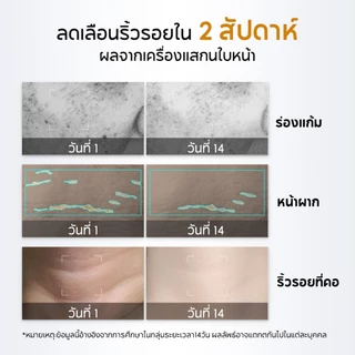 PAPA FEEL [เช้า C เย็น A] 3X Retinol + 5X Ceramide Barrier Moisturizer 80g | ทำให้ผิวเต่งตึง | ลดริ้วรอย | ผิวเนียน ชุ่มชื้น | ผิวสงบลง | ผิวแพ้ง่าย