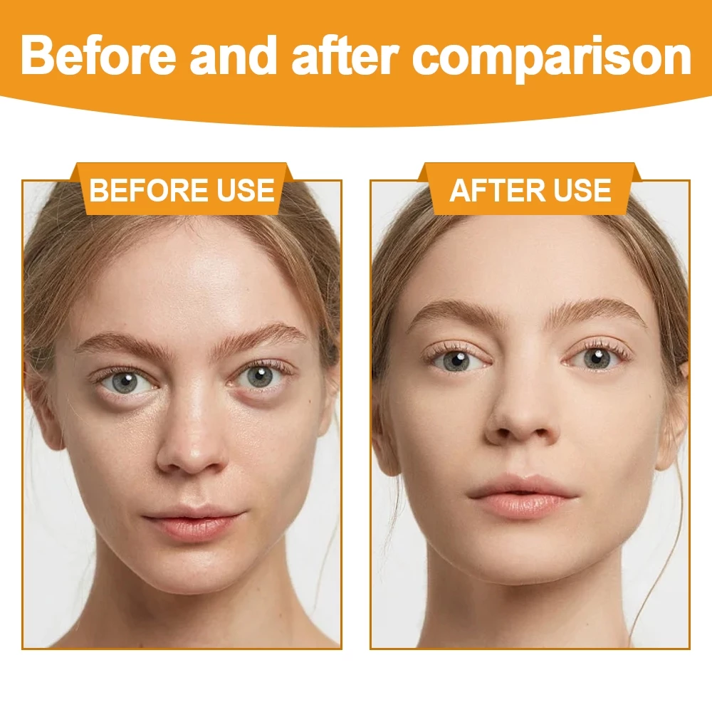 BSKM Vitamin C Serum เซรั่มวิตามินซีธรรมชาติ เซรั่มหน้าขาว ต่อต้านริ้วรอยแห่งวัยสดใส จุดด่างดำจางลง ปรับเส้นให้เรียบ ซ่อมแซม สกินแคร์ 28ml thumbnail 5