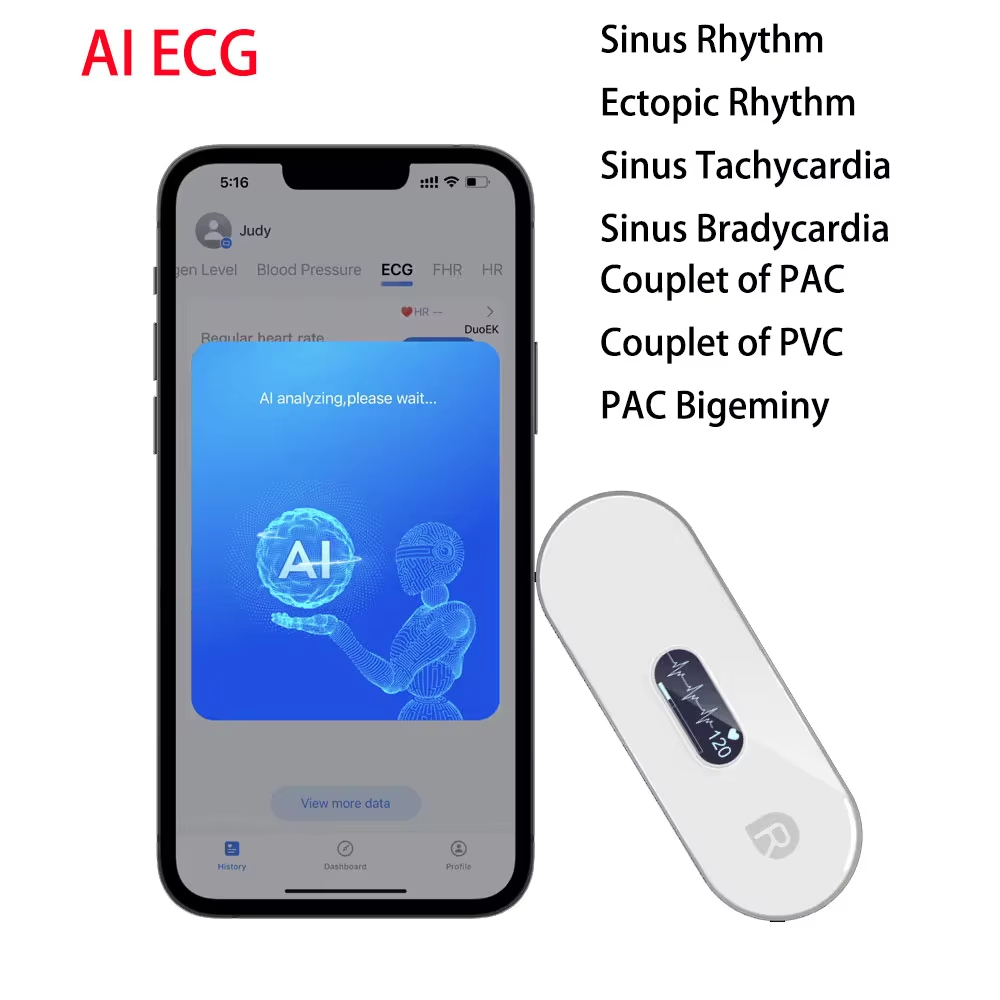บลูทูธ ECG Monitor พร้อม OLED EKG AI AnalysiArrhythmias Holter Heart Health Monitor หน้าจอแสดง EKG แ