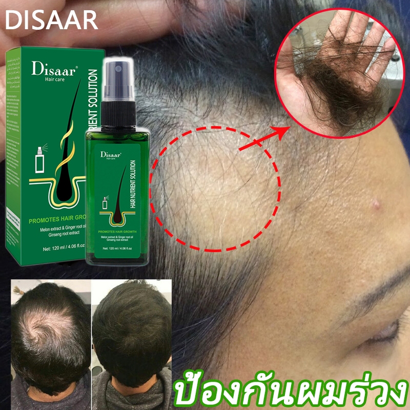 ☘ป้องกันผมร่วง☘Disaar สเปรย์เซรั่มปลูกผม เซรั่มปลูกผม 120ML ช่วยปรับปรุงผมร่วง ลดผมร่วง เร่งผมยาว สู