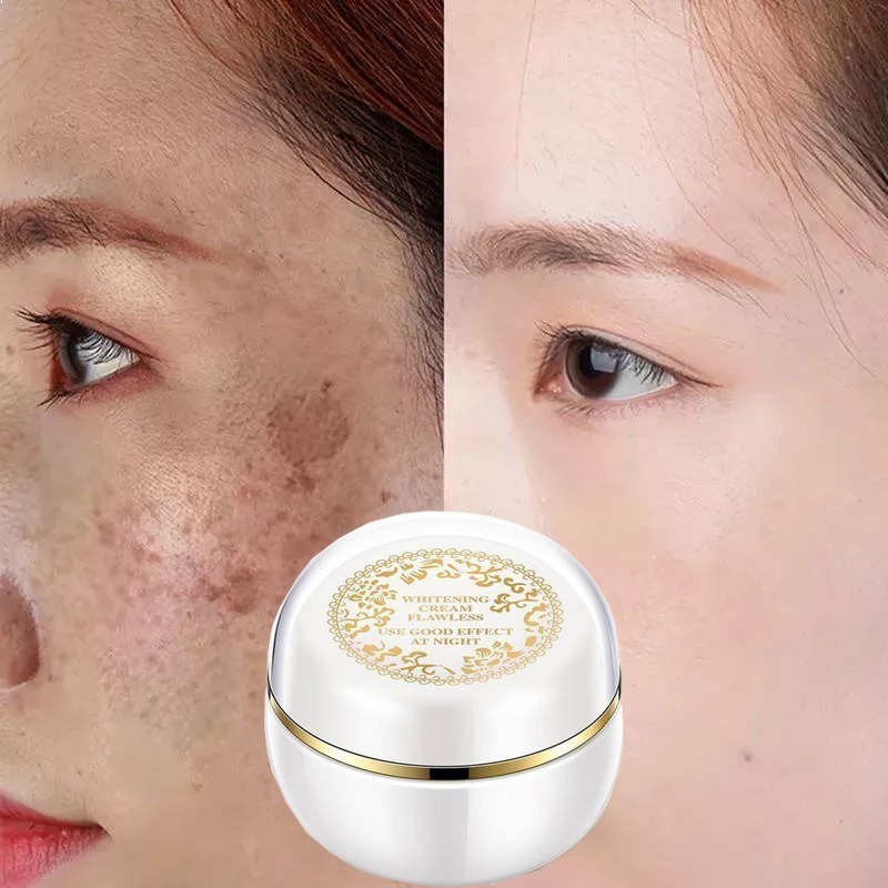 Face Whitening Cream คอนซีลเลอร์ black spot remover Cream 30g moisturizing brightening Face ครีมด่าง