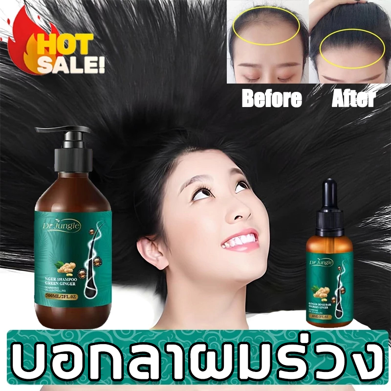 ถูก/แท้ Dr Jungle แชมพูขิง ยาสระผมแก้ผมร่วง ชุดดูแลผมร่วง + เซรั่มขิง 500ml + 30ml ป้องกันผมร่วงอย่างมีประสิทธิภาพ แชมพูเร่งผมยาว ฟื้นฟูผมด้วยสมุนไพร ลดรังแค ควบคุมความมัน บำรุงหนังศีรษะและรากผม
