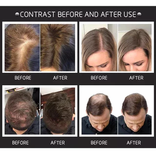 5pcs ผงไฟเบอร์เพิ่มผมหนา Toppik Hair Fibers Powder กันน้ําเหงื่อหนาผม Building Fiber ผมร่วงสีขาวคอนซีลเลอร์บาง Hair Care Growth เครื่องมือสําหรับชายหญิง
