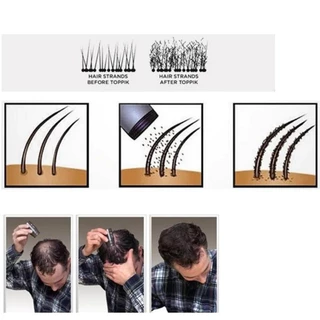 5pcs ผงไฟเบอร์เพิ่มผมหนา Toppik Hair Fibers Powder กันน้ําเหงื่อหนาผม Building Fiber ผมร่วงสีขาวคอนซีลเลอร์บาง Hair Care Growth เครื่องมือสําหรับชายหญิง
