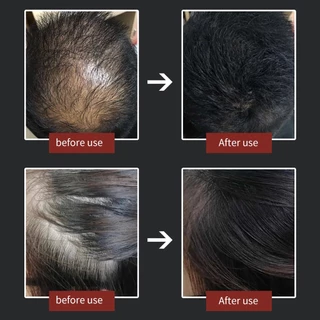 5pcs ผงไฟเบอร์เพิ่มผมหนา Toppik Hair Fibers Powder กันน้ําเหงื่อหนาผม Building Fiber ผมร่วงสีขาวคอนซีลเลอร์บาง Hair Care Growth เครื่องมือสําหรับชายหญิง