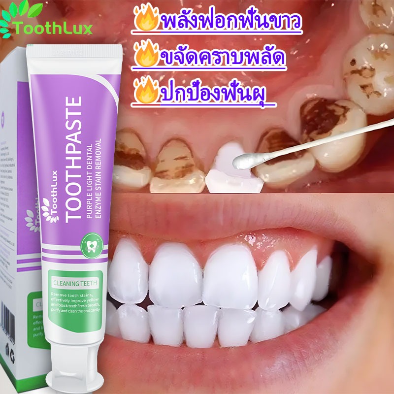 ยาสีฟันฟอกฟันขาว ลมหายใจหอมสดชื่น ลดกลิ่นปาก คอลเกต อ๊อพติค ไวท์ เพอร์เพิล 100g