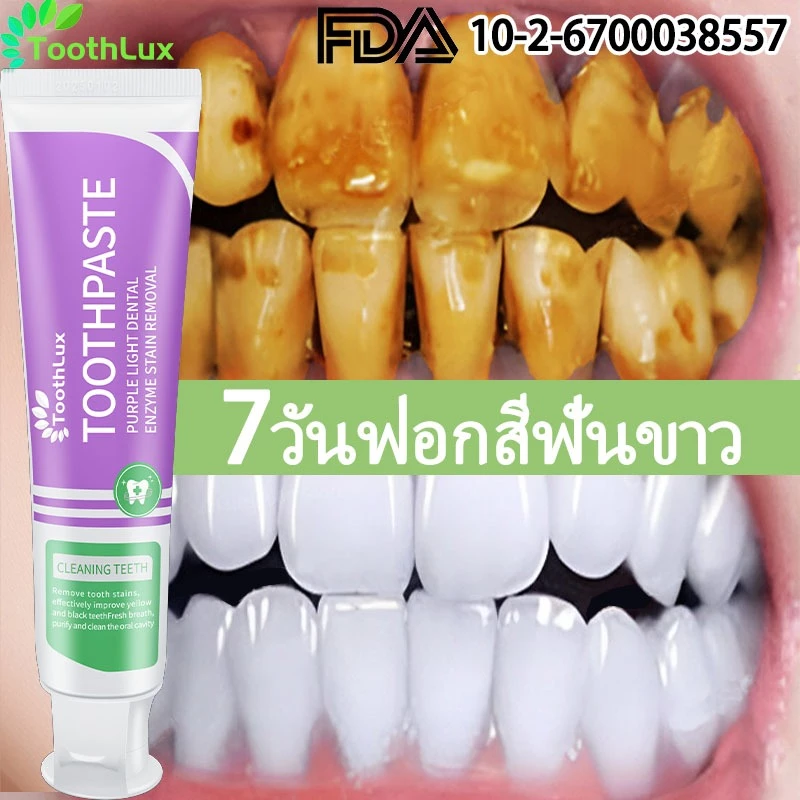 ชุดสุดคุ้ม โปรโมชั่น ยาสีฟันฟันขาว ลมหายใจหอมสดชื่นทั้งวัน ฟันปวดหายแล้ว ลดกลิ่นปาก ยาสีฟันไวท์เทนนิ่ง สมุนไพร คอลเกต อ๊อพติค ไวท์ เพอร์เพิล 100g