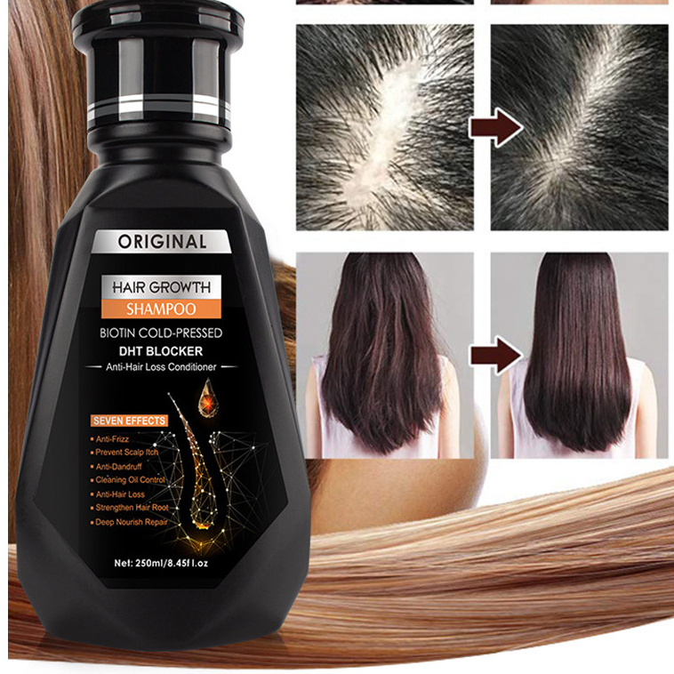Te Hair Growth Essential Oil ไบโอตินสกัดเย็น DHT Blocker และแชมพูปลูกผม Anti-Hair Loss Conditioner
