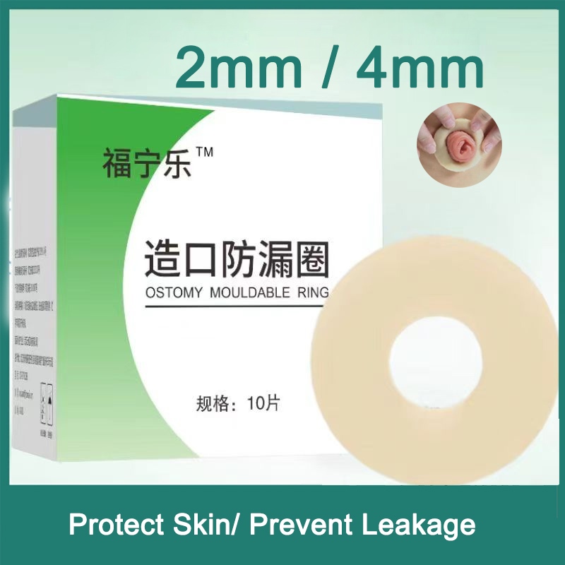 2 & 4 มม. 5/10 ชิ้น Ostomy Paste แหวนยืดสร้างป้องกันการรั่วซึมป้องกันการรั่วซึมป้องกันผิว