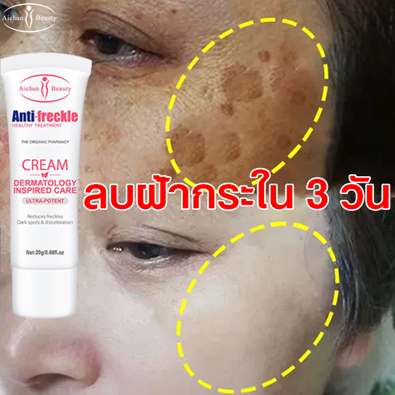 100% ของแท้ 💖 Aichun ครีมแก้ฝ้า กำจัดกระ ฝ้า จุดด่างดำ ลดจุดด่างดำ ให้ความชุ่มชื้น ฟื้นฟูผิว เติมน้ำให้ผิว ลดฝ้ากระ กระจ่างใส ลดฝ้าและจุดด่างดำ