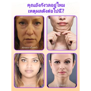 Vหน้าวี-ครีมลด ยกกระชับเอสเซ้นส์ใบหน้าเพื่อลดกล้ามเนื้อ masseter และคางสองชั้น ลดริ้วรอยและขจัดคางสองชั้น