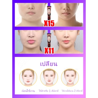 Vหน้าวี-ครีมลด ยกกระชับเอสเซ้นส์ใบหน้าเพื่อลดกล้ามเนื้อ masseter และคางสองชั้น ลดริ้วรอยและขจัดคางสองชั้น
