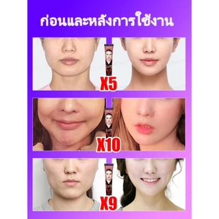 Vหน้าวี-ครีมลด ยกกระชับเอสเซ้นส์ใบหน้าเพื่อลดกล้ามเนื้อ masseter และคางสองชั้น ลดริ้วรอยและขจัดคางสองชั้น