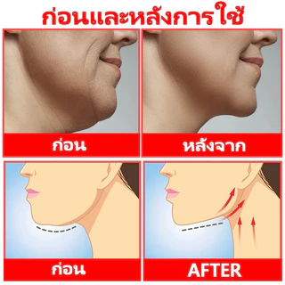Vหน้าวี-ครีมลด ยกกระชับเอสเซ้นส์ใบหน้าเพื่อลดกล้ามเนื้อ masseter และคางสองชั้น ลดริ้วรอยและขจัดคางสองชั้น