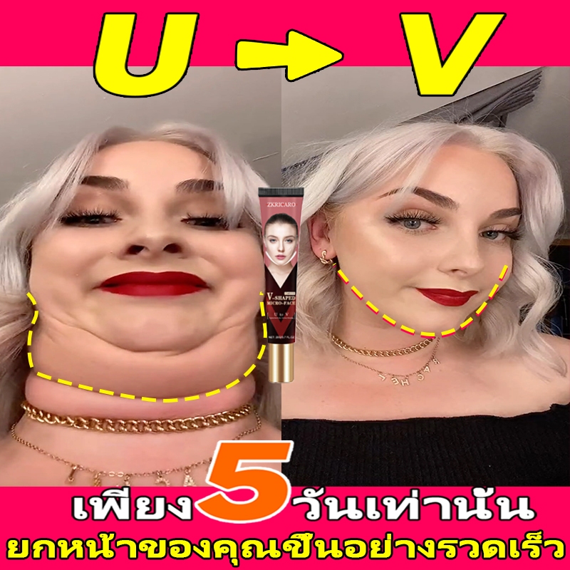 Vหน้าวี-ครีมลด ยกกระชับเอสเซ้นส์ใบหน้าเพื่อลดกล้ามเนื้อ masseter และคางสองชั้น ลดริ้วรอยและขจัดคางสองชั้น