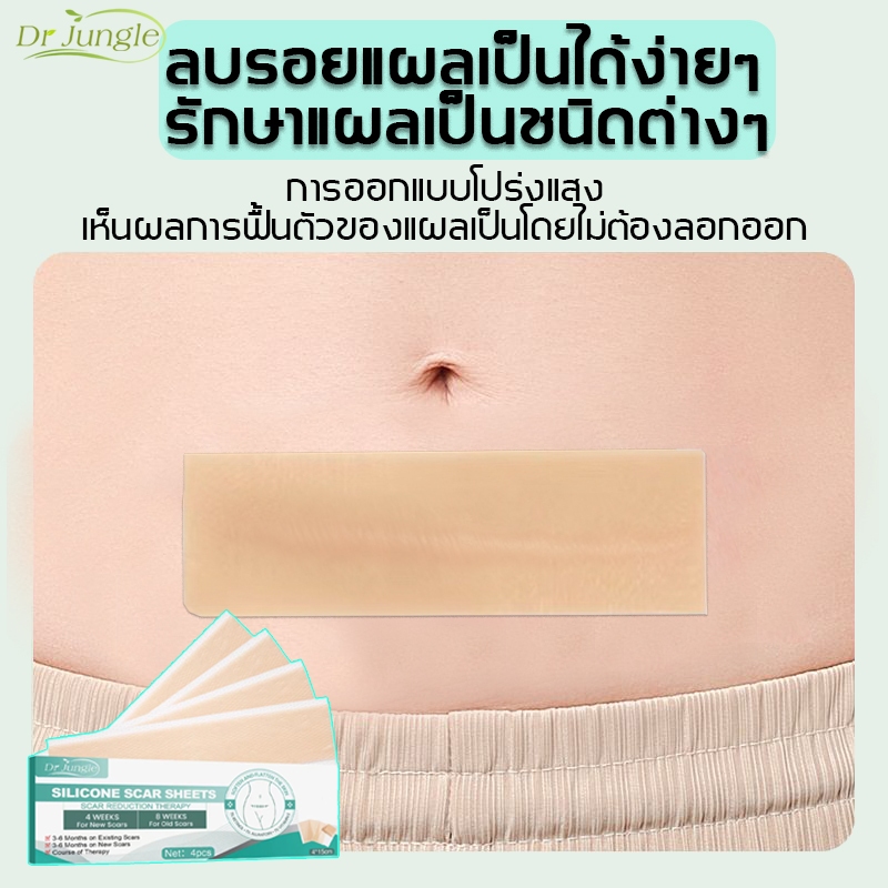 🔥ของแท้🔥Drjungle แผ่นแปะลดรอยแผลเป็น แผ่นแปะซิลิโคน ลดรอยแผลเป็นใหม่และเก่า ลดรอยแผลนูน แผลเป็น และแผลจากการตัดผ่าตัด ฟื้นฟูผิวส้ม และเส้นการเจริญเติบโตของผิวให้เรียบเนียน ขนาด 4*7.5cm