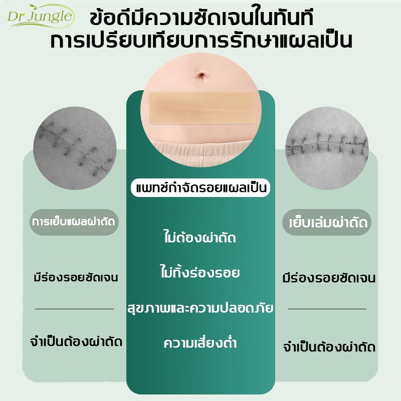 🔥ของแท้🔥Drjungle แผ่นแปะลดรอยแผลเป็น แผ่นแปะซิลิโคน ลดรอยแผลเป็นใหม่และเก่า ลดรอยแผลนูน แผลเป็น และแผลจากการตัดผ่าตัด ฟื้นฟูผิวส้ม และเส้นการเจริญเติบโตของผิวให้เรียบเนียน ขนาด 4*7.5cm