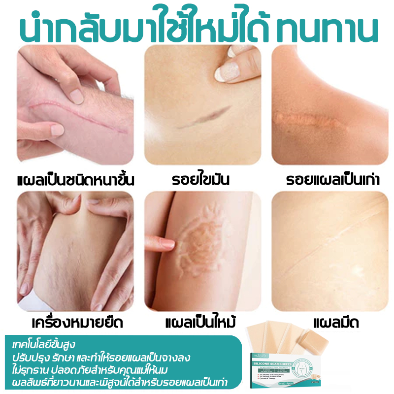 🔥ของแท้🔥Drjungle แผ่นแปะลดรอยแผลเป็น แผ่นแปะซิลิโคน ลดรอยแผลเป็นใหม่และเก่า ลดรอยแผลนูน แผลเป็น และแผลจากการตัดผ่าตัด ฟื้นฟูผิวส้ม และเส้นการเจริญเติบโตของผิวให้เรียบเนียน ขนาด 4*7.5cm