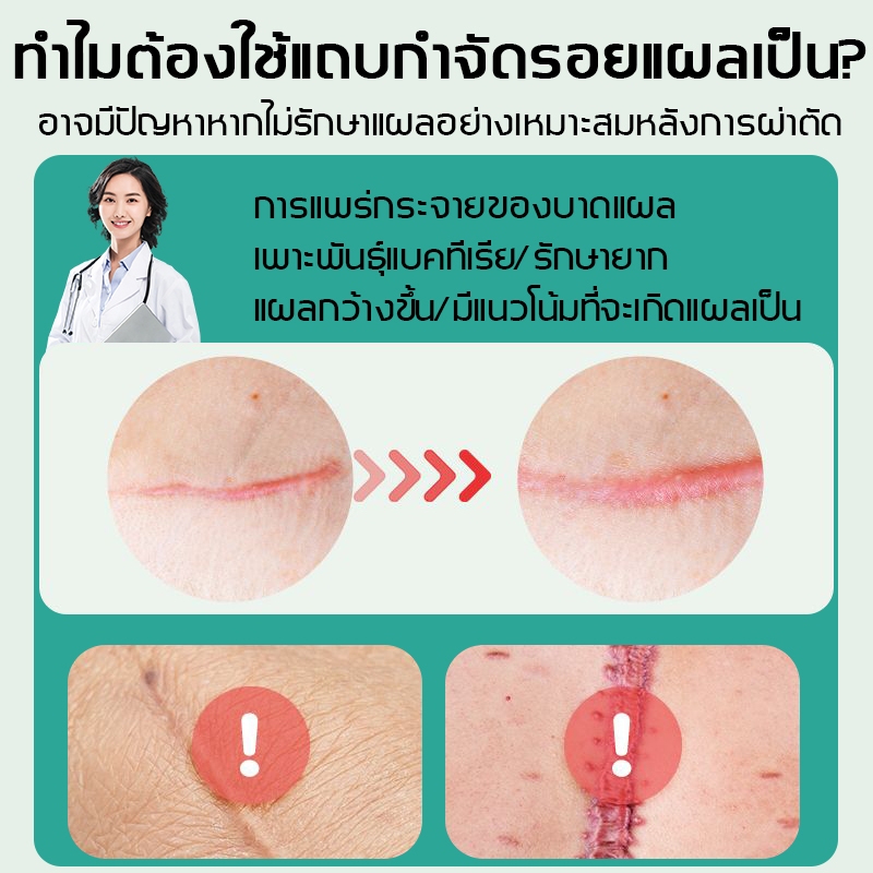 🔥ของแท้🔥Drjungle แผ่นแปะลดรอยแผลเป็น แผ่นแปะซิลิโคน ลดรอยแผลเป็นใหม่และเก่า ลดรอยแผลนูน แผลเป็น และแผลจากการตัดผ่าตัด ฟื้นฟูผิวส้ม และเส้นการเจริญเติบโตของผิวให้เรียบเนียน ขนาด 4*7.5cm