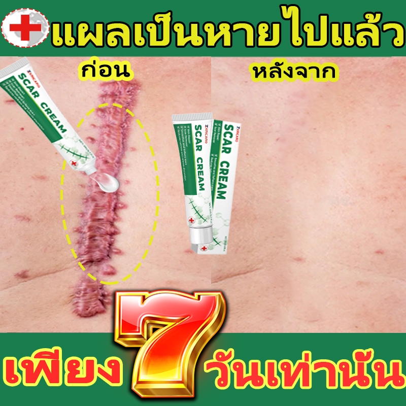 บอกลารอยแผลเป็น เจลทารอยแผลนูน แผลผ่าตัด ลดหลุมสิว ฟื้นฟูผิว ใช้ง่าย