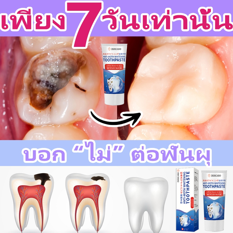✈️นำเข้าจากประเทศญี่ปุ่น✈️ยาสีฟันสำหรับฟันผุยาสีฟันฟอกฟันขาวและป้องกันฟันผุ ซ่อมแซมฟันผุ ขจัดกลิ่นปาก ทำให้ลมหายใจสดชื่น ขจัดคราบพลัค ทำความสะอาดล้ำลึก ต่อสู้กับโรคเหงือกอักเสบ ขจัดคราบและปกป้องฟัน