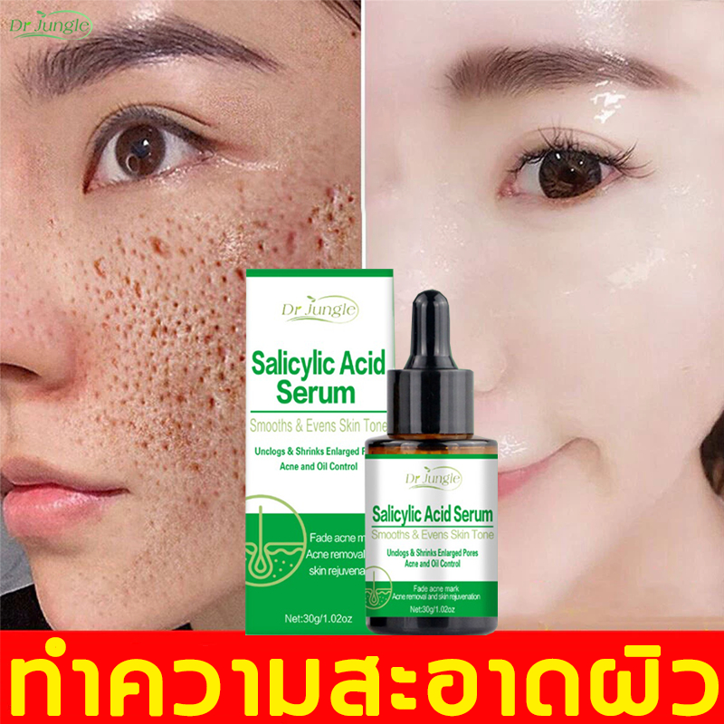 🔥ของแท้🔥 Dr. Jungle เซรั่มกรดซาลิไซลิก กระชับรูขุมขน เซรั่มกระชับรูขุมขน ให้ความชุ่มชื้น ไม่เหนียวเหนอะหนะ เติมน้ำให้ผิว ฟื้นฟูผิว ลดสิวอุดตัน ลดรอยสิว หลุมสิว ควบคุมความมัน 30g