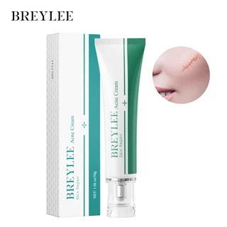 BREYLEE ครีมสมุนไพร ลบรอยแผลเป็นจากสิว แผลผ่าตัด และแผลไฟไหม้ สูตรสมุนไพร ฟื้นฟูผิวให้เรียบเนียน จางลงอย่างเป็นธรรมชาติ remove scar