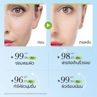 SADOER Anti-Wrinkle Cream ครีมลดริ้วรอย ฟื้นฟูผิวแก่ก่อนวัย กระชับผิว เต่งตึง ชุ่มชื้น