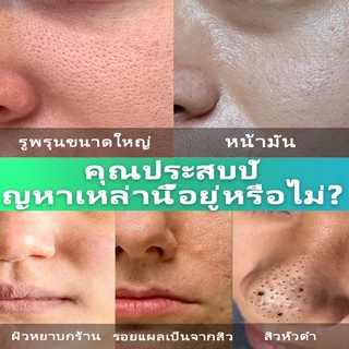 ✈️นำเข้าจากเกาหลี✈️ เซรั่มกระชับรูขุมขน รูขุมขน​​กระชับแก่นแท้ ลดรอยสิว การกำจัดสิวหัวดำ ลดริ้วรอย ผิวชุ่มชื้น ซ่อมแซมน้ํามัน ควบคุมความมัน กระชับรูขุมขน ผิว เหมาะสําหรับผิวแพ้ง่าย