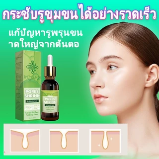 ✈️นำเข้าจากเกาหลี✈️ เซรั่มกระชับรูขุมขน รูขุมขน​​กระชับแก่นแท้ ลดรอยสิว การกำจัดสิวหัวดำ ลดริ้วรอย ผิวชุ่มชื้น ซ่อมแซมน้ํามัน ควบคุมความมัน กระชับรูขุมขน ผิว เหมาะสําหรับผิวแพ้ง่าย