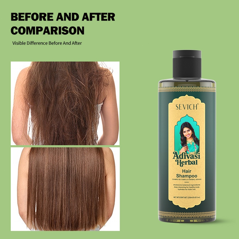 SEVICH แชมพูบํารุงเส้นผมป้องกันผมร่วง 200มล