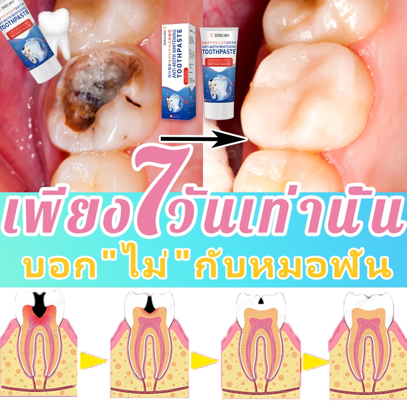 พร้อมส่ง 🚀 ยาสีฟันไวท์เทนนิ่ง ป้องกันฟันผุ ลดเหงือกร่น ขจัดคราบลมหายใจสดชื่น