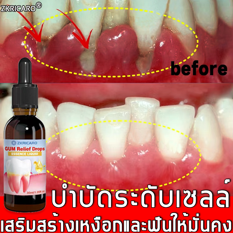 【สูงคุณภาพ】เจลดูแลเหงือก ลมหายใจสดชื่น,บรรเทาเหงือกบวมและเจ็บ,เจลซ่อมแซมฟัน,เจลซ่อมแซมฟันทํา,ความสะอาดลึก