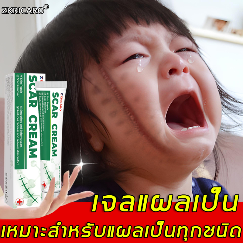 ครีมทาแผลเป็น แก้ปัญหาผิวฝังแน่น ฟื้นฟูเซลล์ผิวใหม่ ครีมรักษาแผลเป็น บอกลาแผลเป็น