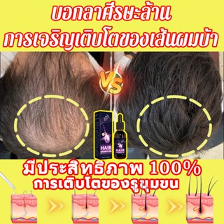 เป็นประจําศีรษะล้านเอสเซ้นปลูกผมส่งเสริมการเจริญเติบโตของเส้…
